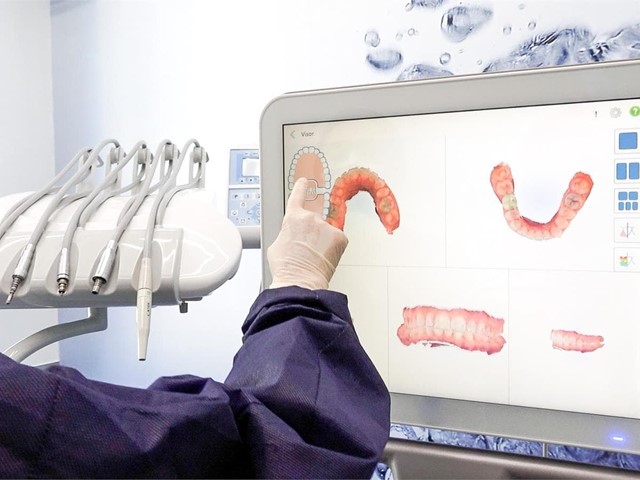 ¿A qué edad se pueden colocar implantes dentales?