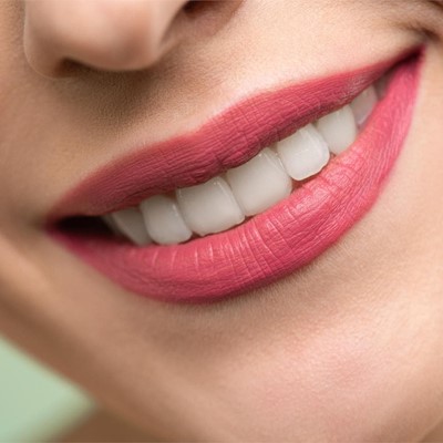 ¿Cada cuánto tiempo debo realizarme una limpieza dental?