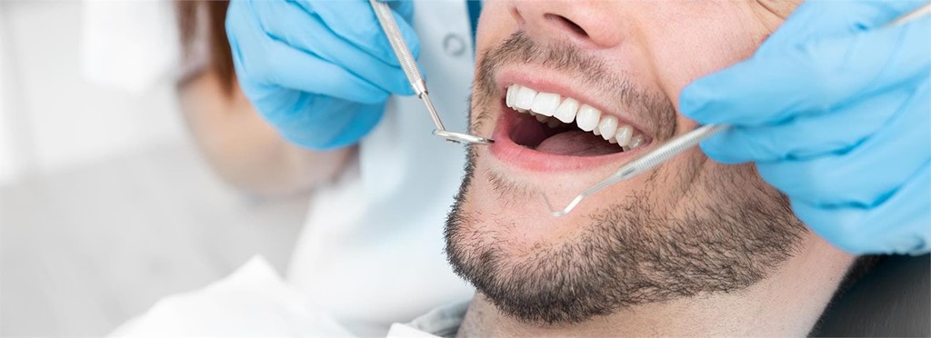 ¿Cómo cuidar y mantener tus implantes dentales a largo plazo?