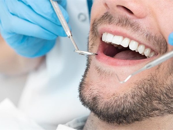 ¿Cómo cuidar y mantener tus implantes dentales a largo plazo?