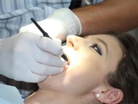 ¿Cuáles son los beneficios de la endodoncia?