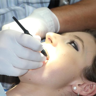 ¿Cuáles son los beneficios de la endodoncia?