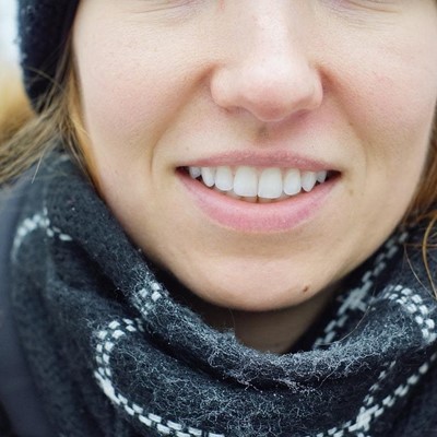 ¿Cuáles son los tratamientos de estética dental más demandados?