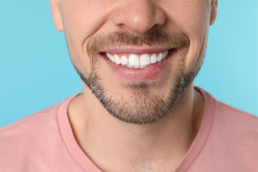 ¿Cuándo realizarse un blanqueamiento dental?