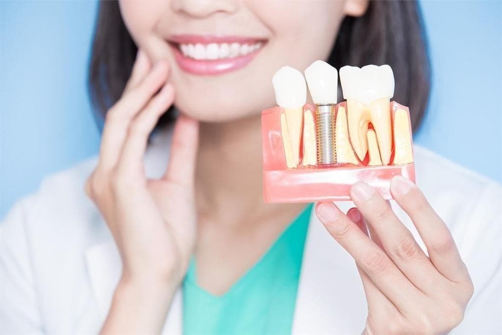 ¿Cuánto suelen durar los implantes dentales?