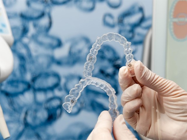 Diferencias entre el tratamiento Invisalign Lite y Full