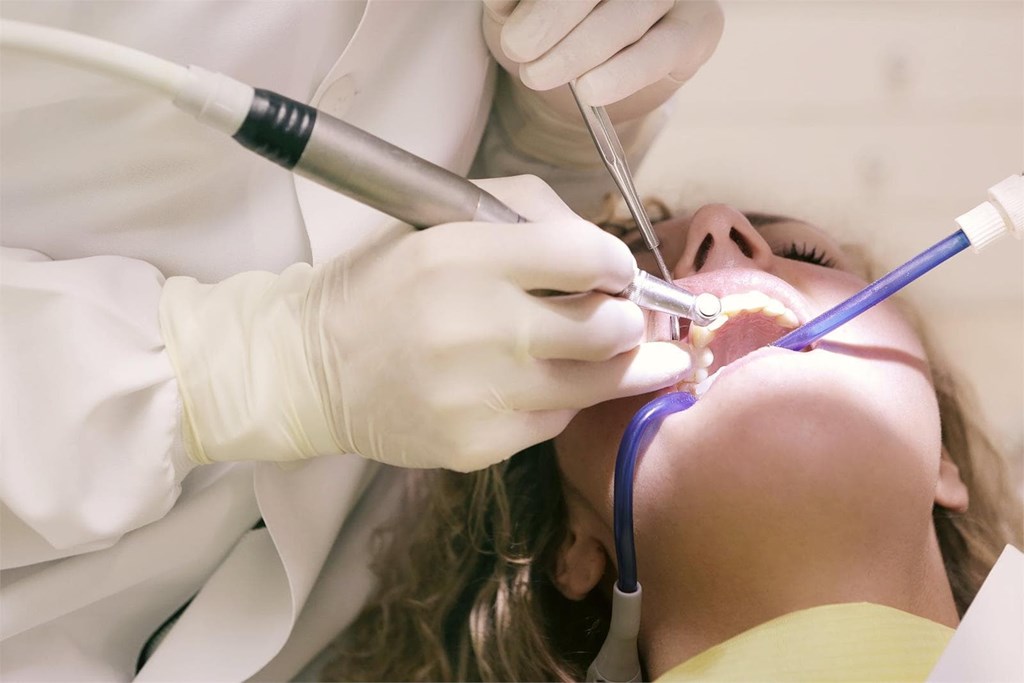 Diferencias y características de los tipos de implantes dentales 