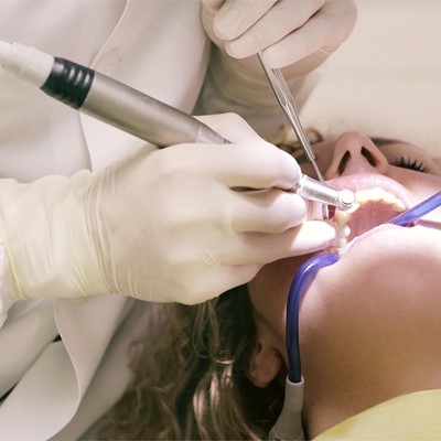 Diferencias y características de los tipos de implantes dentales