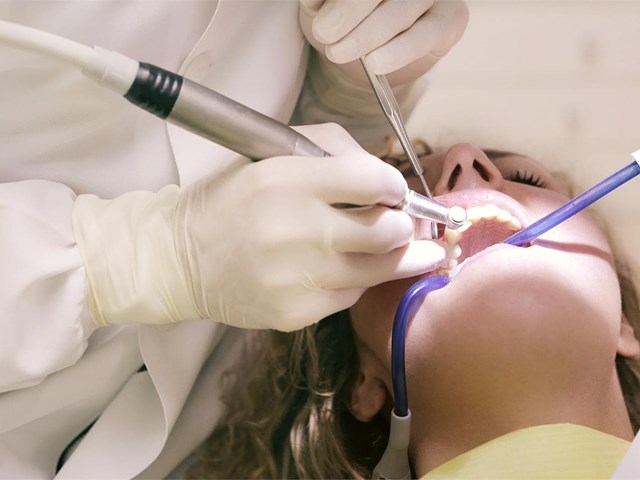 Diferencias y características de los tipos de implantes dentales 