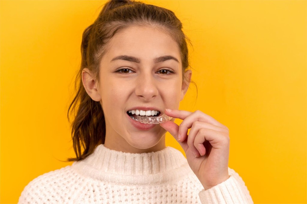 ¿El sistema invisalign lo pueden utilizar niños?