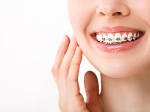 ¿El tratamiento de ortodoncia ayuda a tener una buena higiene dental?