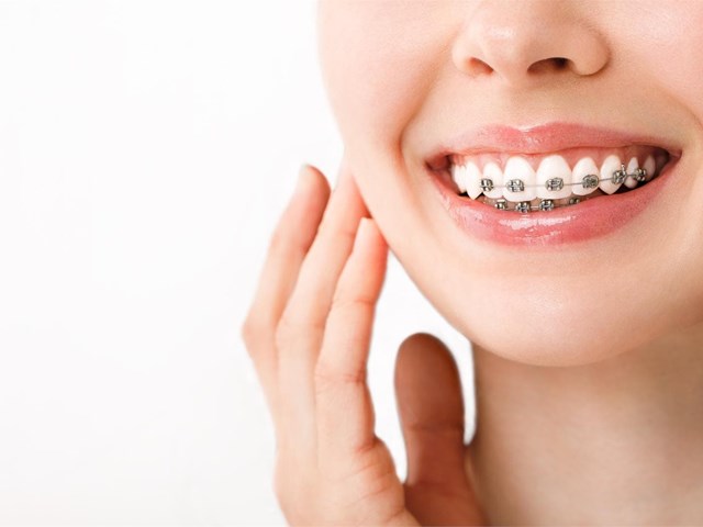 ¿El tratamiento de ortodoncia ayuda a tener una buena higiene dental?