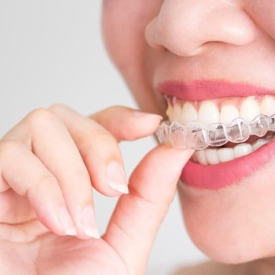¿Es más eficaz la ortodoncia invisible o los Brackets?