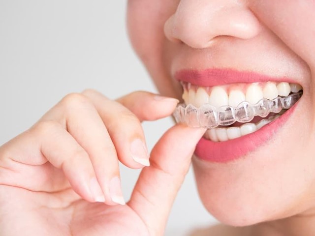 ¿Es más eficaz la ortodoncia invisible o los Brackets? 