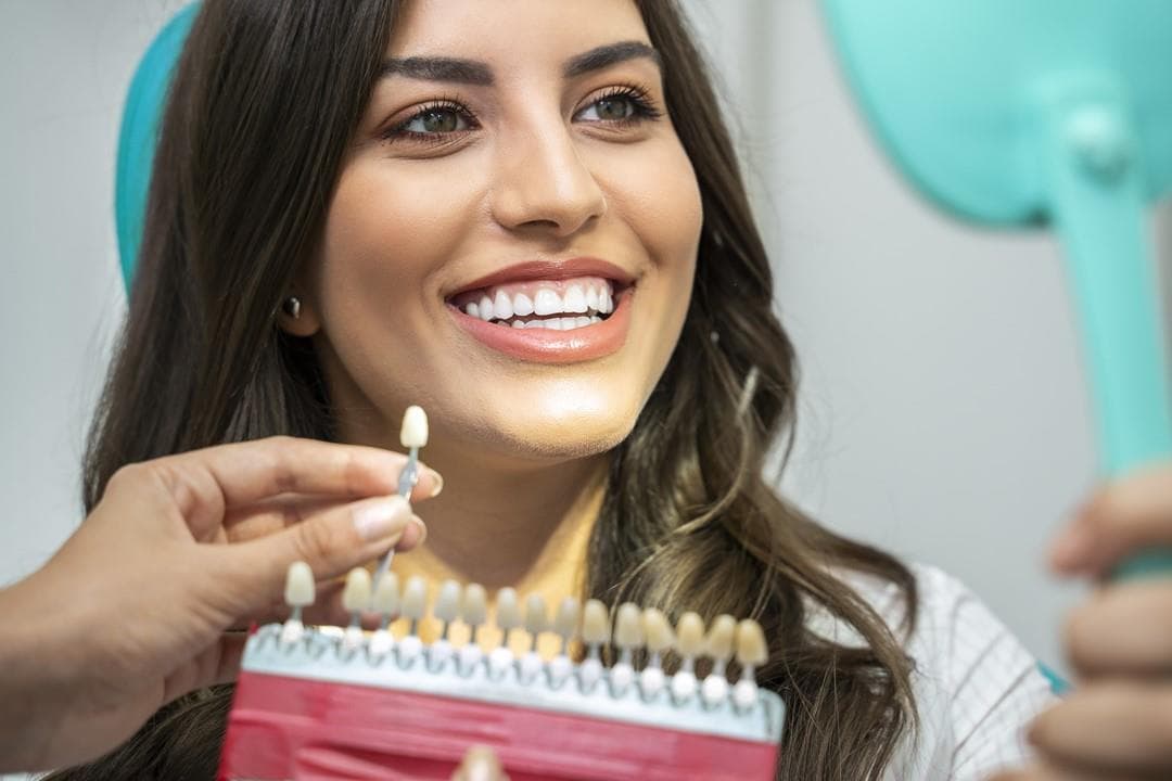 Carillas dentales sin tallado en Vilagarcía