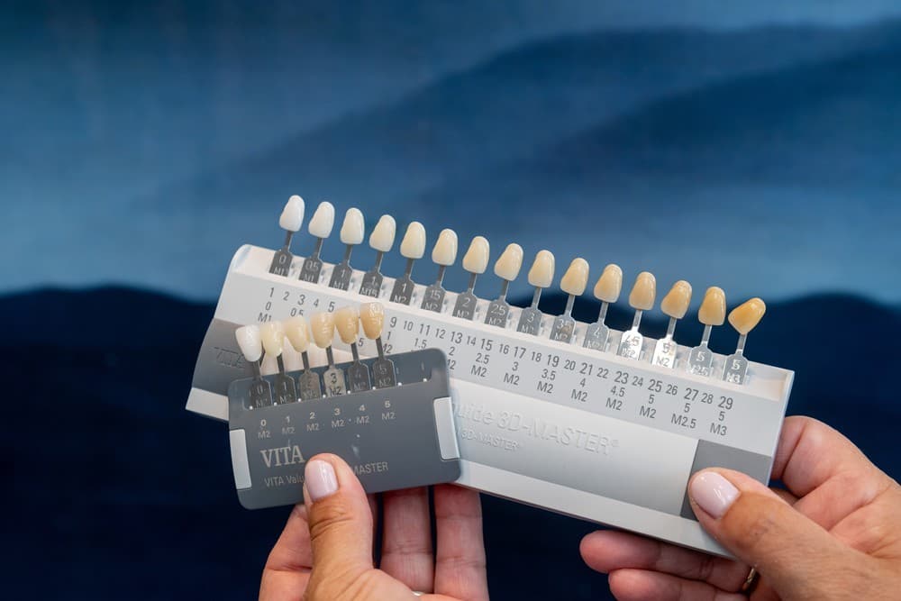 Estética dental en Vilagarcía