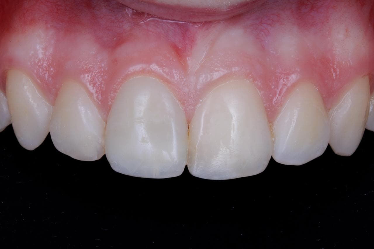 Tratamientos de estética dental