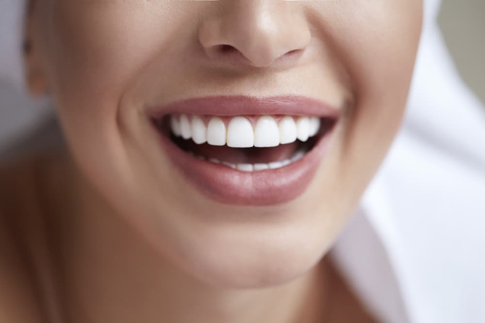 Estética dental en Vilagarcía