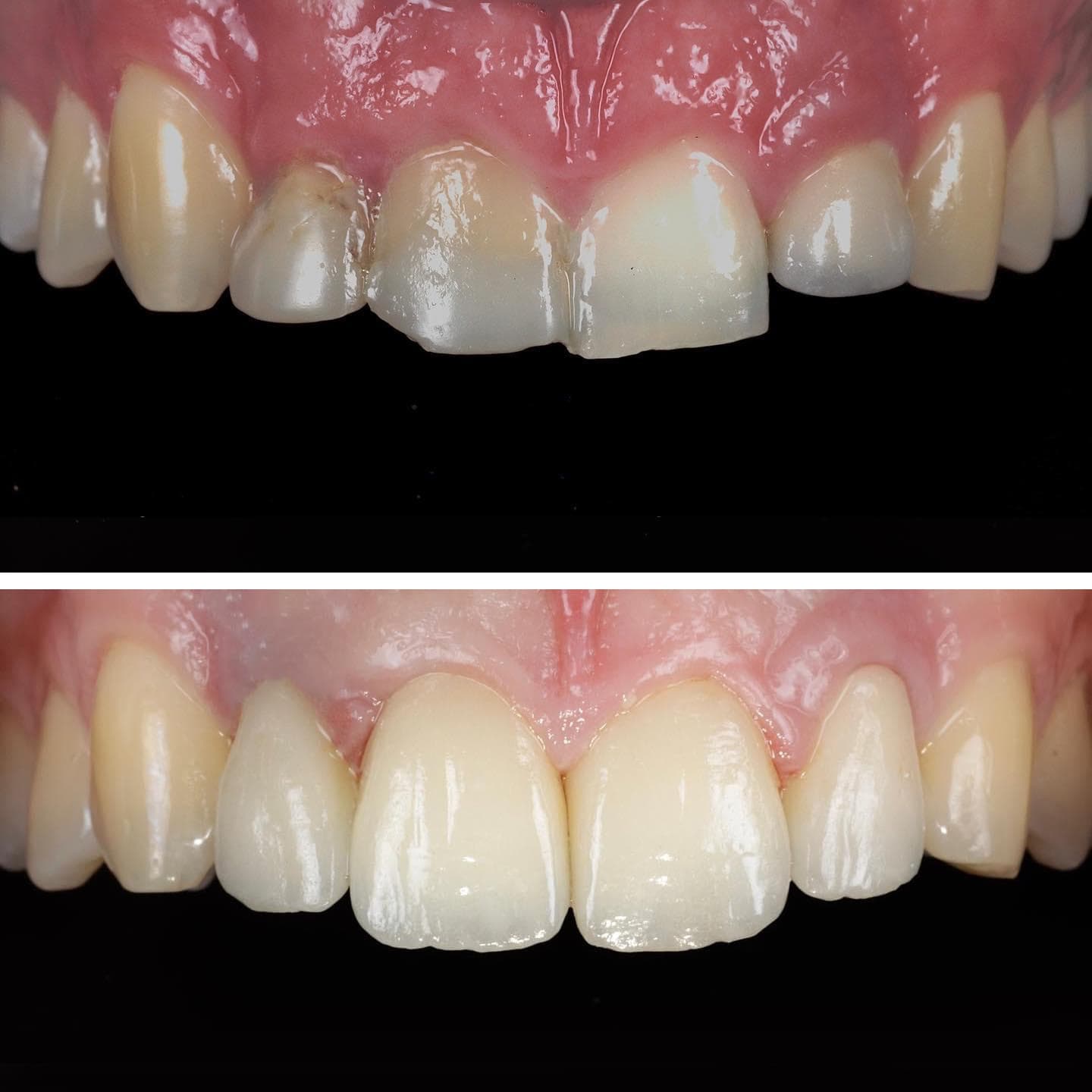 Estetica dental en Vilagarcía