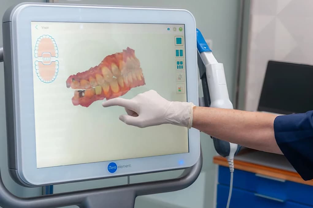 Brackets en Vilagarcía