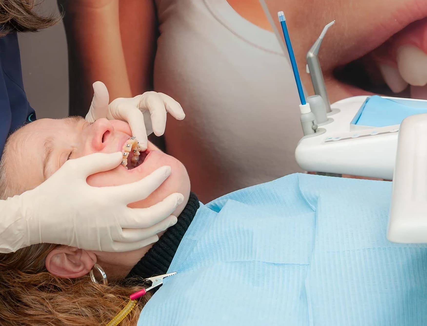 Brackets metálicos en Vilagarcía