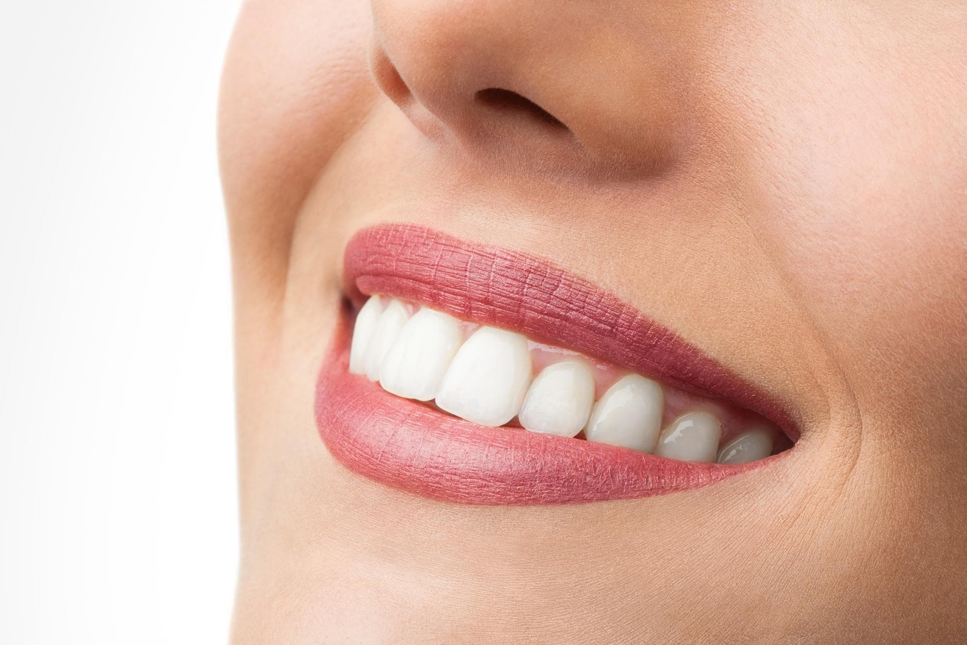 Blanqueamiento dental en Vilagarcía