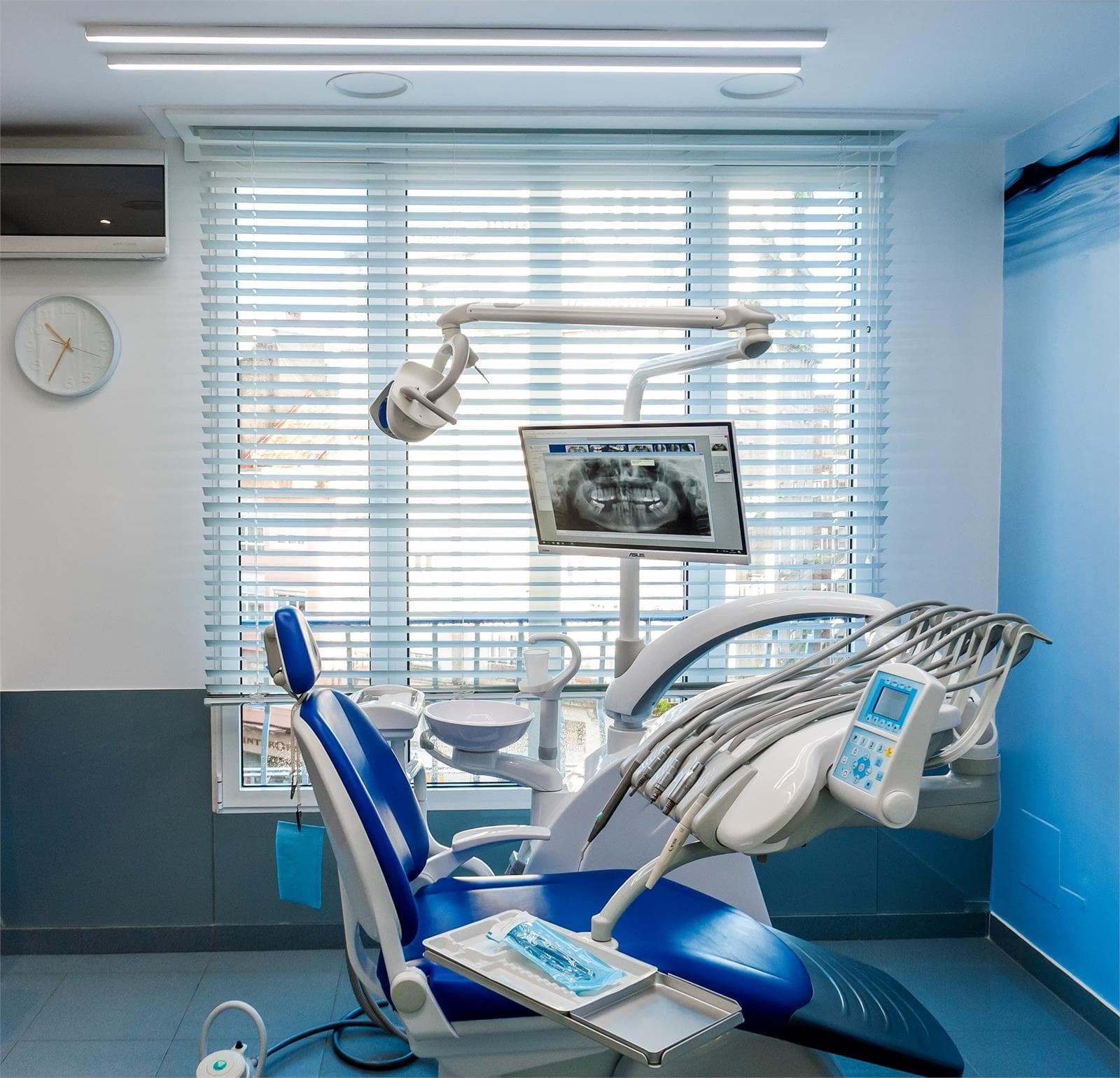 Las ventajas de los implantes dentales Straumann - Imagen 1