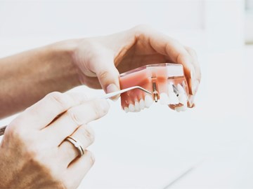 ¿No has descubierto todavía los beneficios de los implantes dentales?