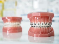 Ortodoncia e higiene: descubre cómo los brackets pueden ayudar a mejorar tu salud bucodental