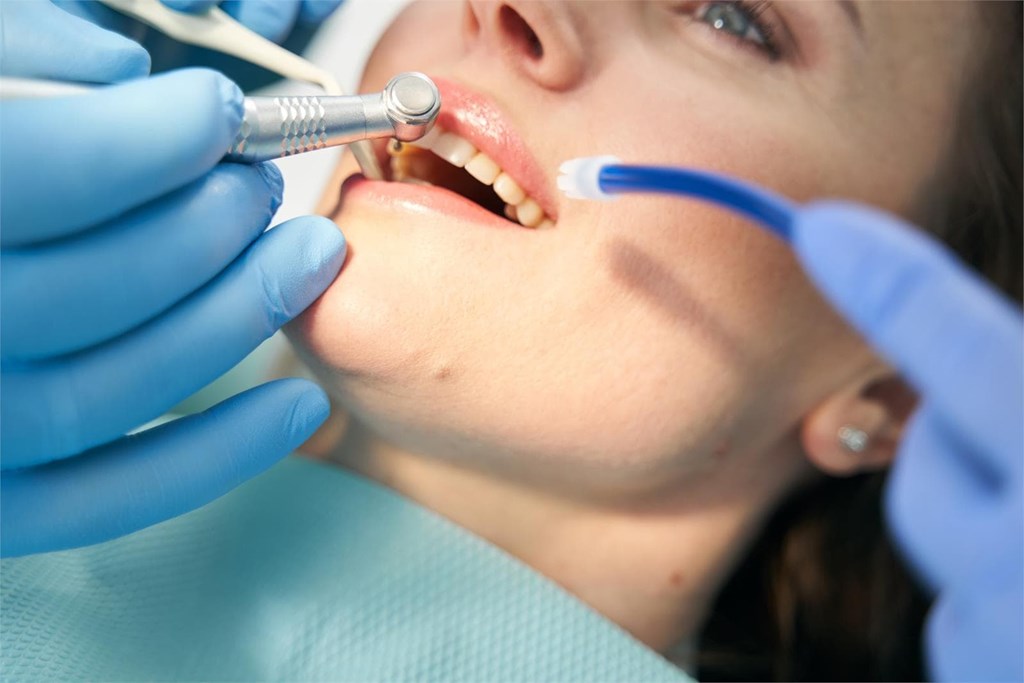 ¿Qué tener en cuenta después de una endodoncia?