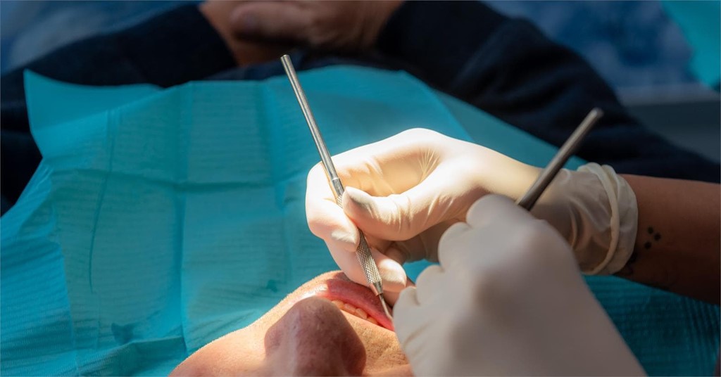 Regeneración ósea para tu boca: ¿qué es?