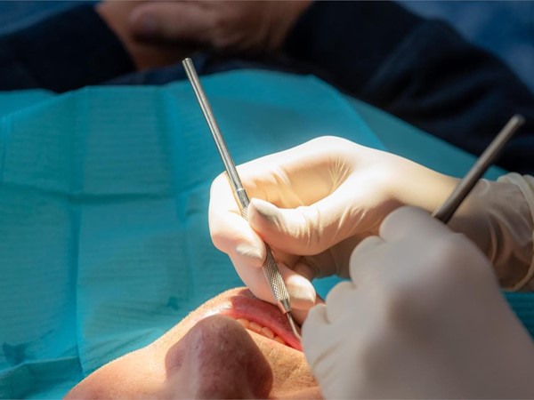 Regeneración ósea para tu boca: ¿qué es?