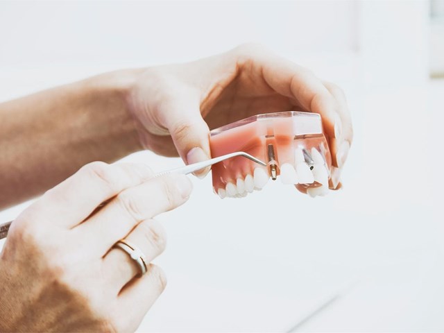 ¿Se puede poner un implante dental en un solo diente?